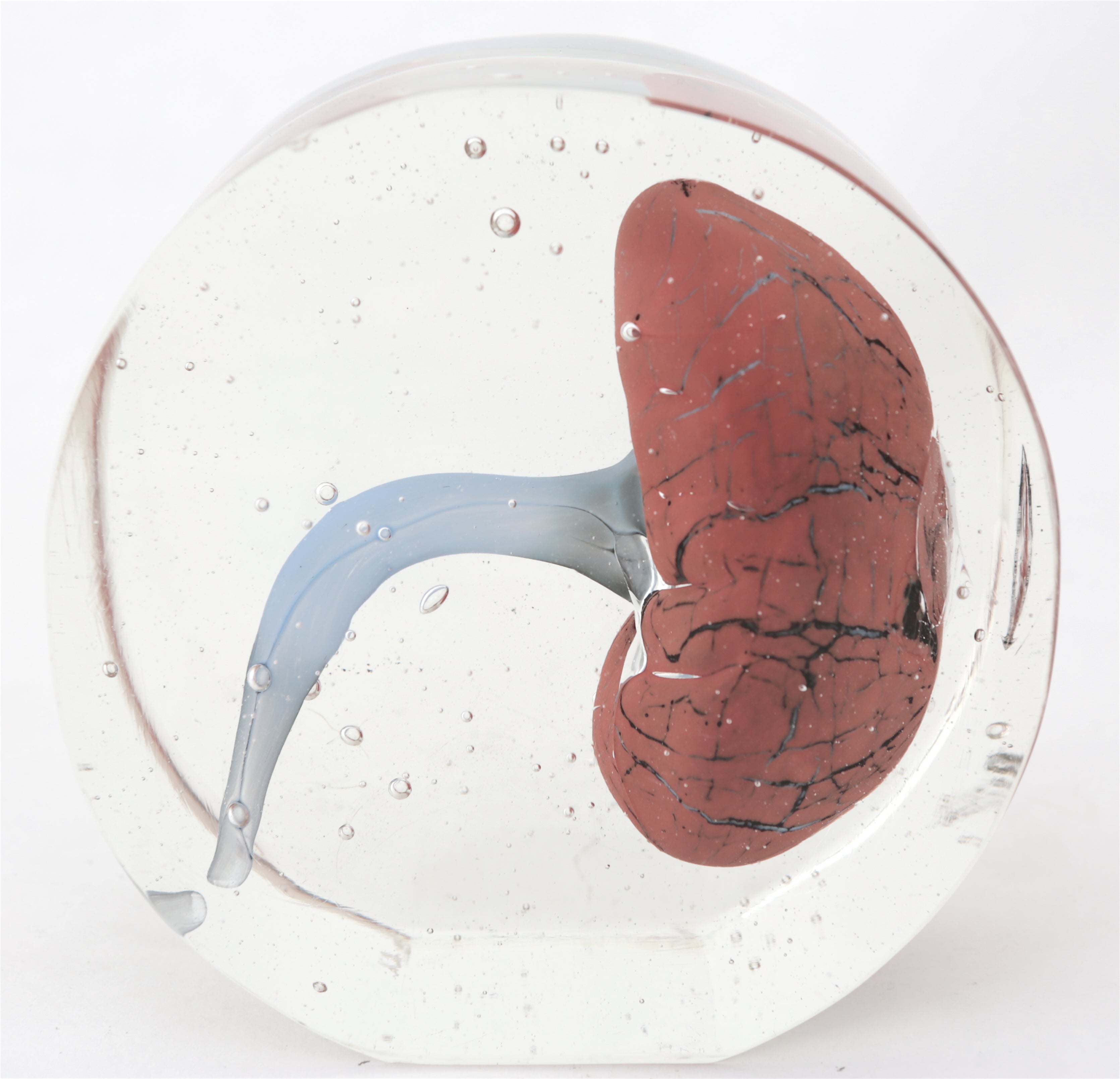 'Kidney' | 13x12.5x7cm