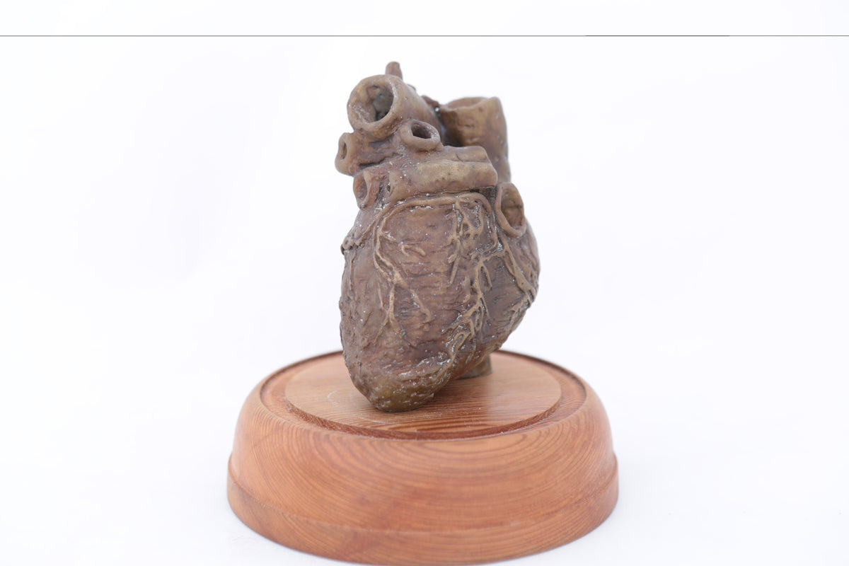 'Tachycardia I' by Tegan Hamilton
